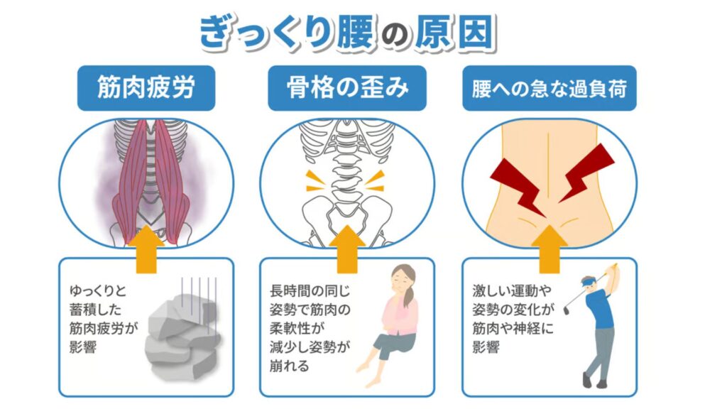 ぎっくり腰について知っておくべきこと